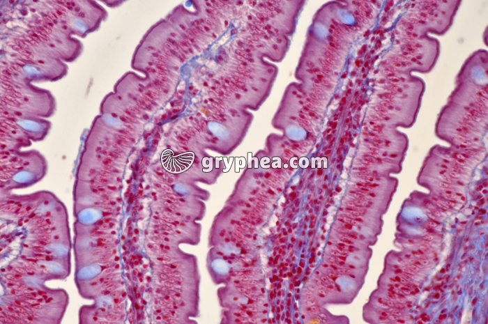 Duodenum x100 - gryphea.org